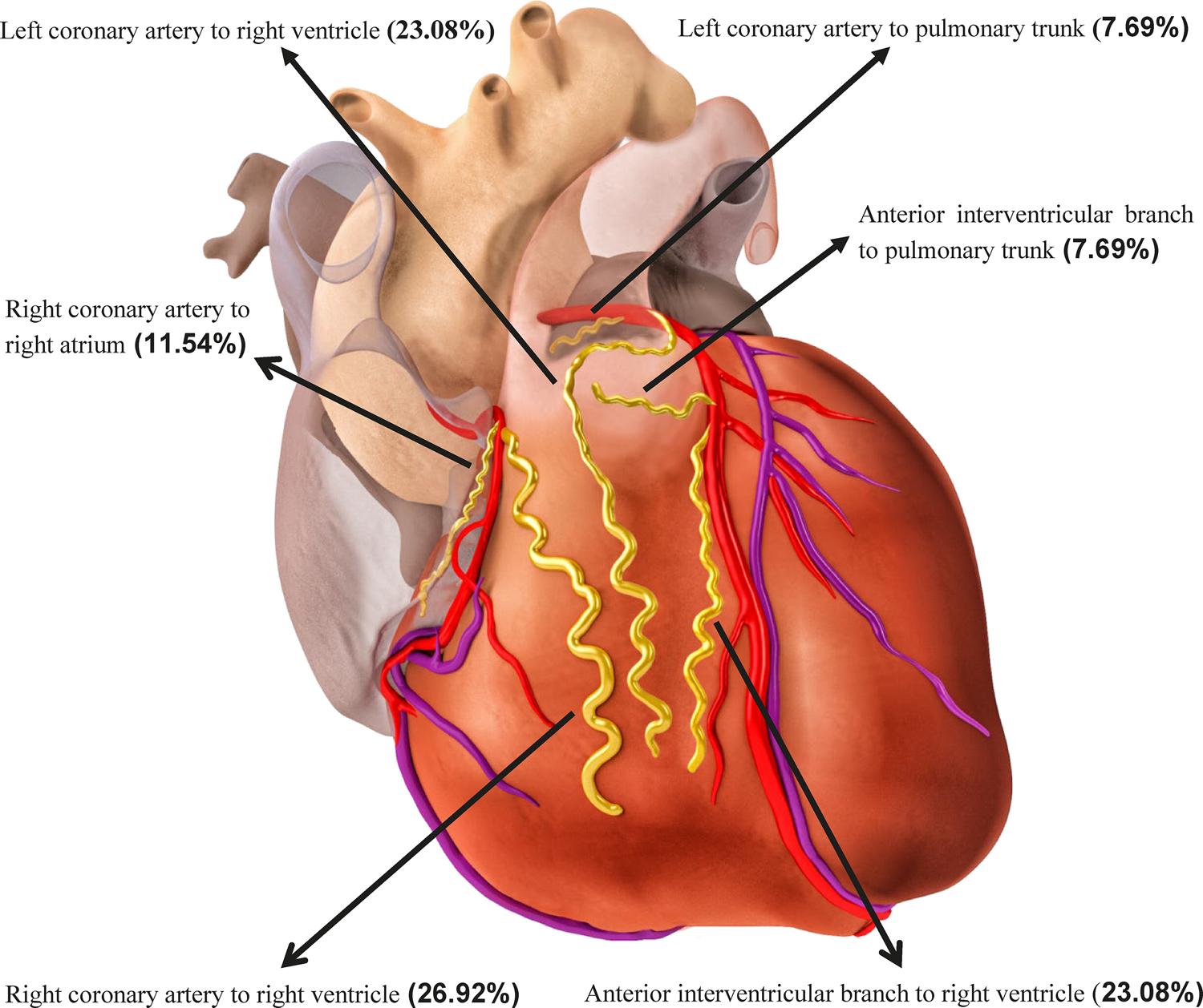 Coronary Fistula Closure