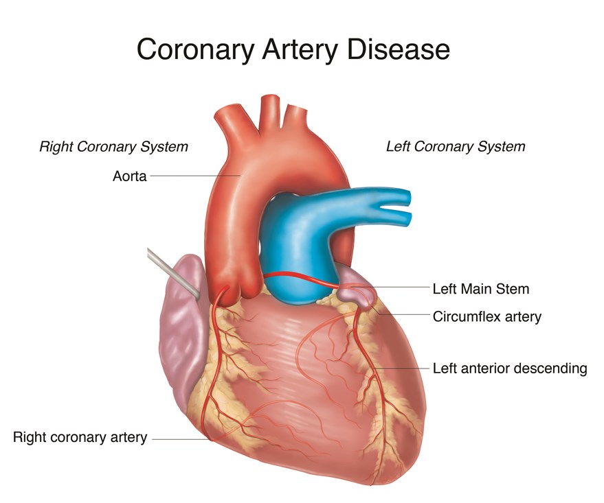 Left Main Coronary Interventions
